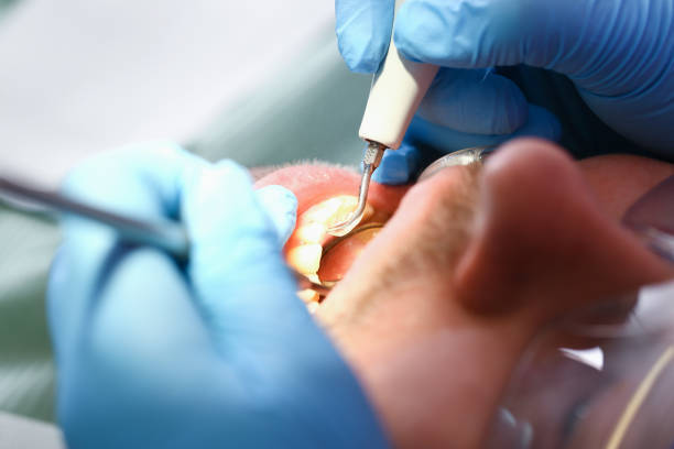 Best Emergency Dental Services for Seniors in Somers, MT